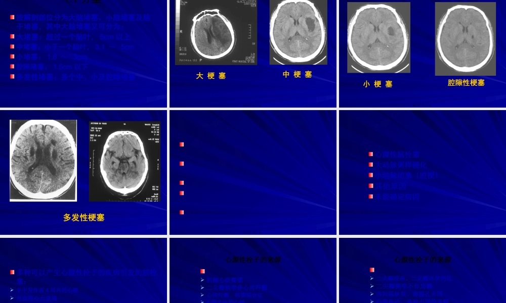 TOAST缺血性卒中分型.pptx