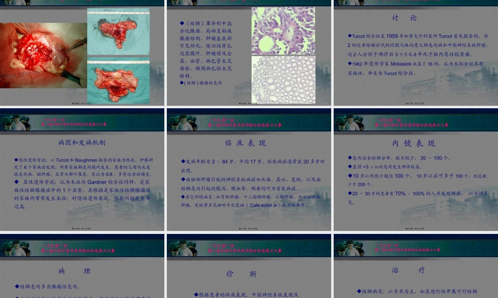 Turcot综合症.pptx