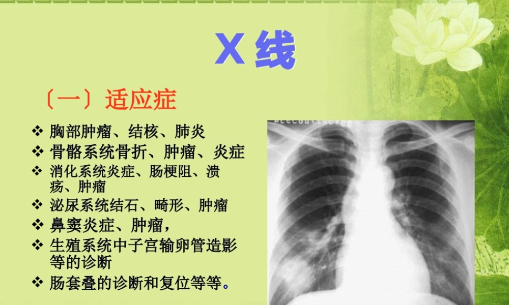 X线CT-DSA--MRI-PETCT-超声的适应症禁忌优势及缺点.pptx