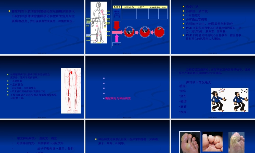 《糖尿病足》-PPT文档.pptx
