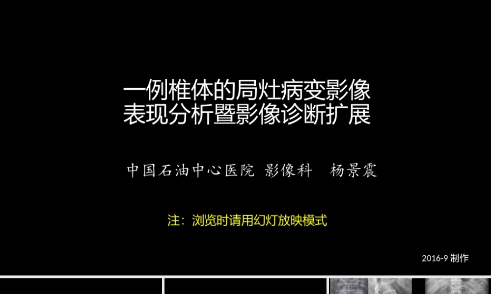 一例椎体的局灶病变影像表现分析暨影像诊断扩展(1).pptx