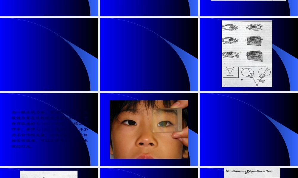 三棱镜在眼科的应用...pptx