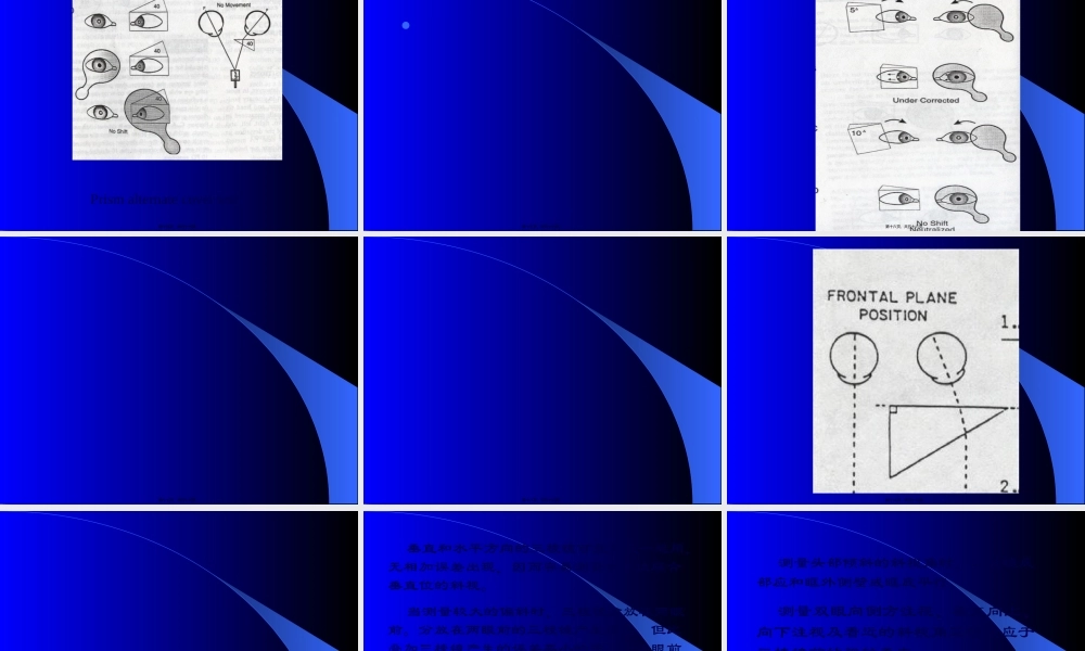 三棱镜在眼科的应用...pptx