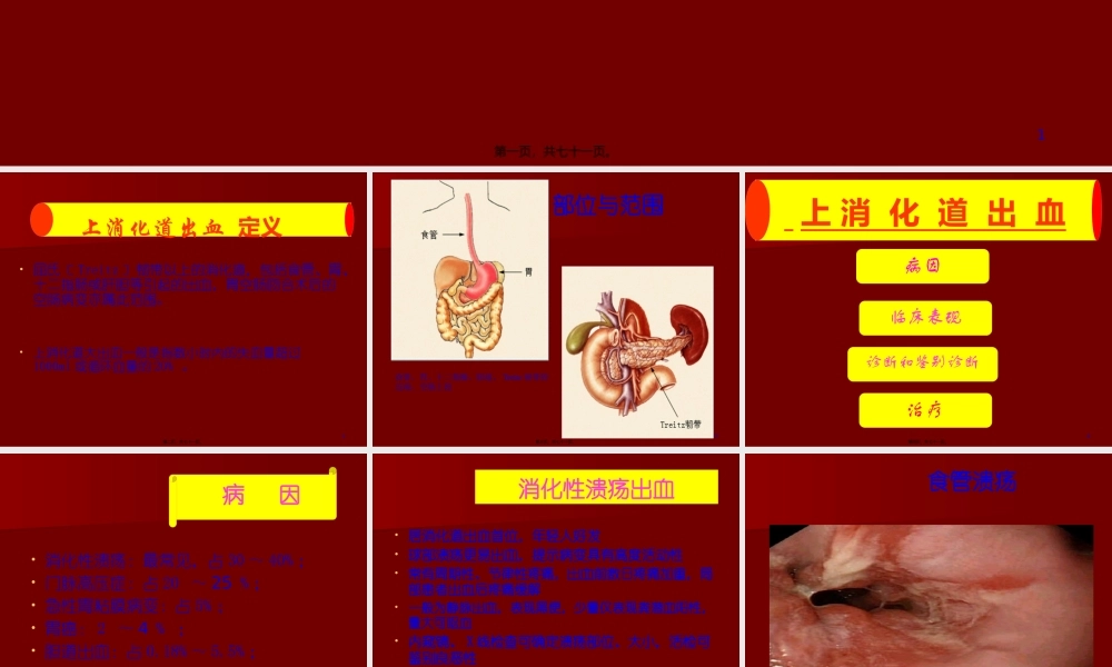 上消化道出血33.pptx