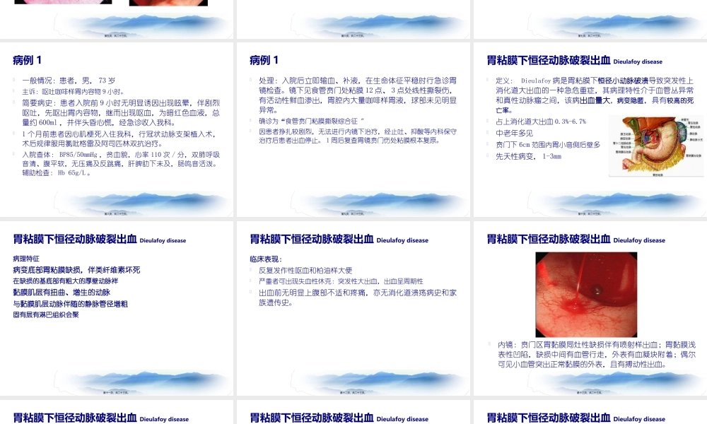 上消化道出血少见病因lcc.pptx