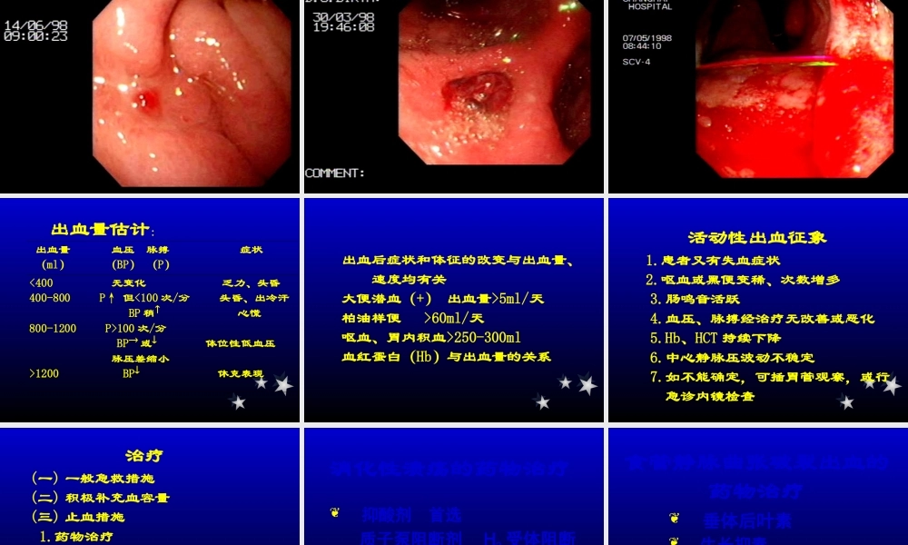 上消化道出血病例内镜.pptx