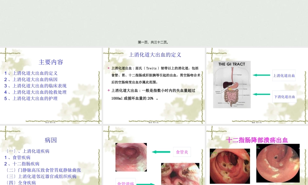 上消化道大出血的.pptx