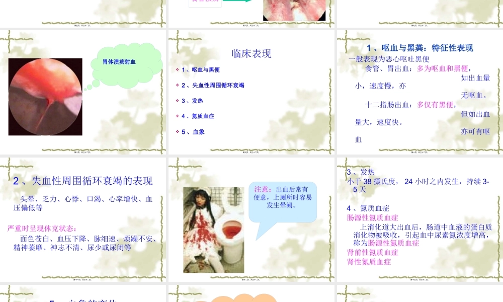 上消化道大出血的.pptx