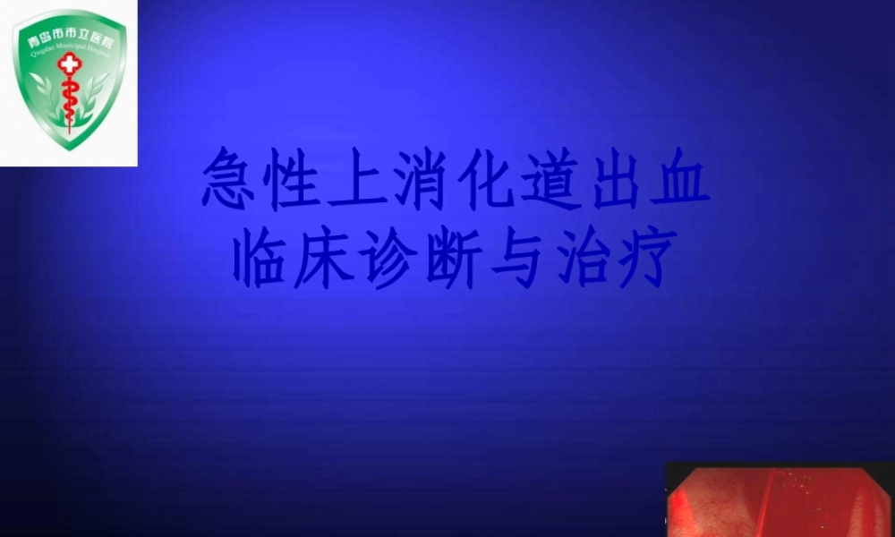 上消化道大出血的诊治.pptx