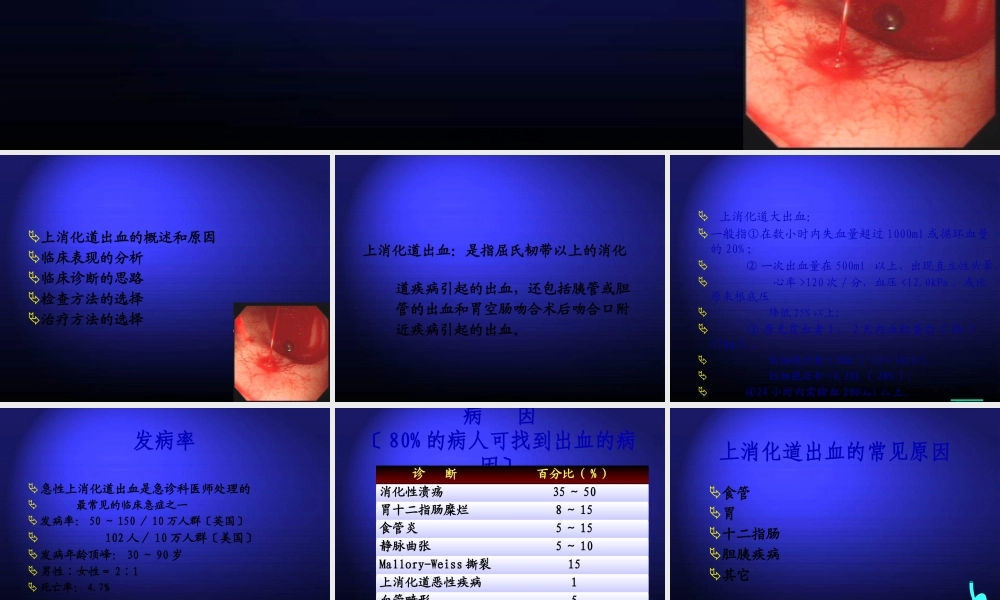 上消化道大出血的诊治.pptx