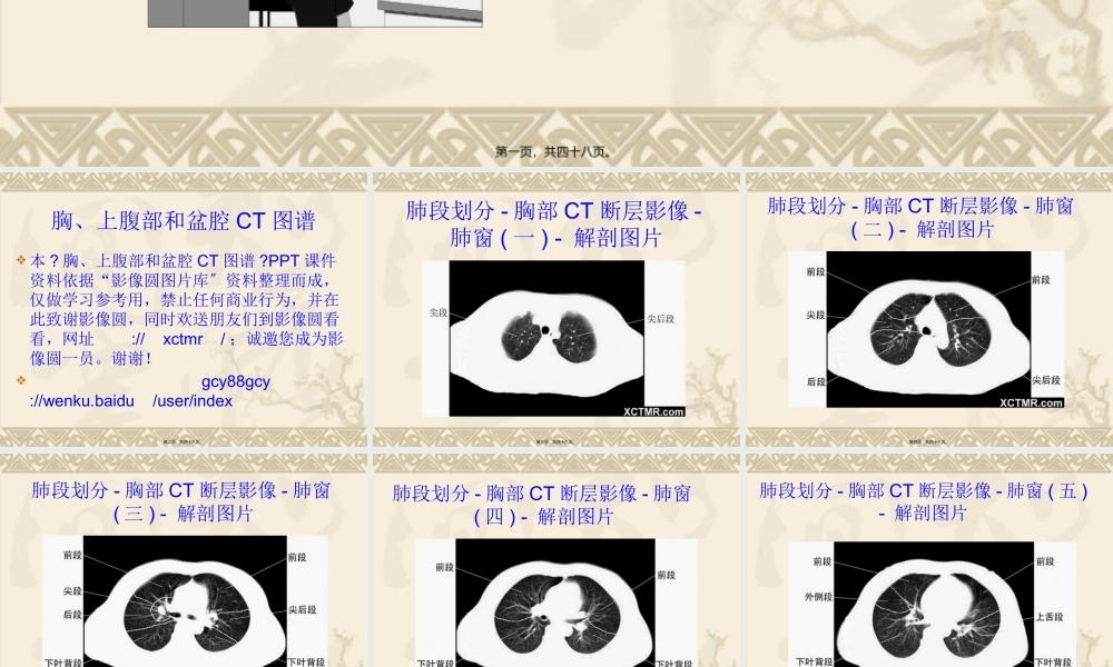上腹和盆腔CT详细实用图解.ppt.pptx
