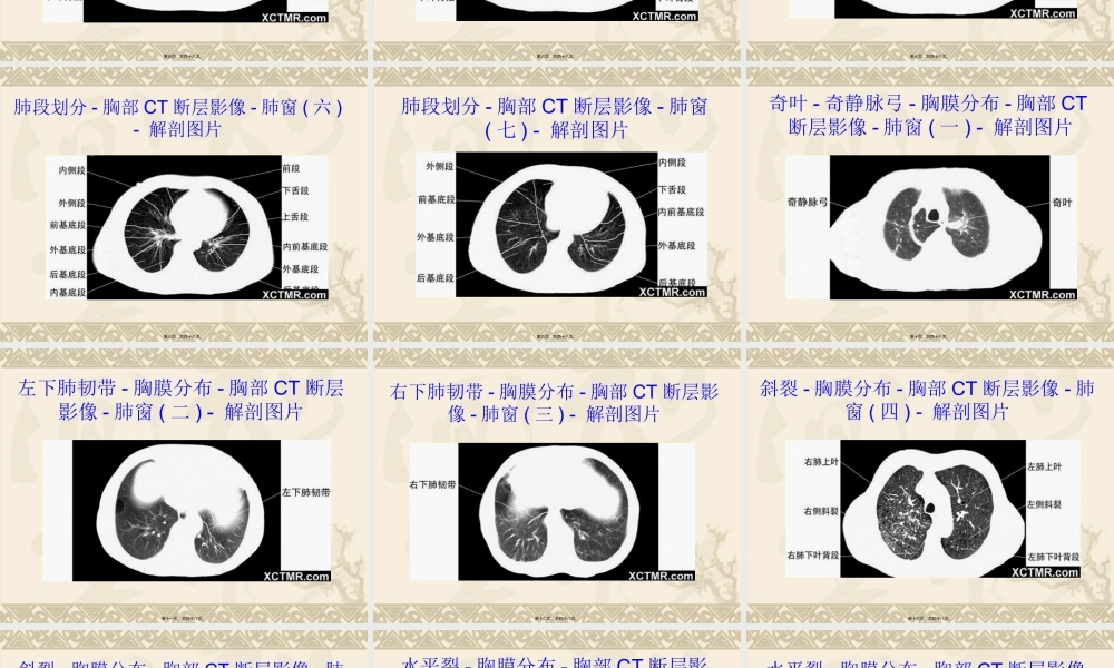 上腹和盆腔CT详细实用图解.ppt.pptx