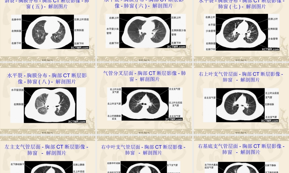 上腹和盆腔CT详细实用图解.ppt.pptx