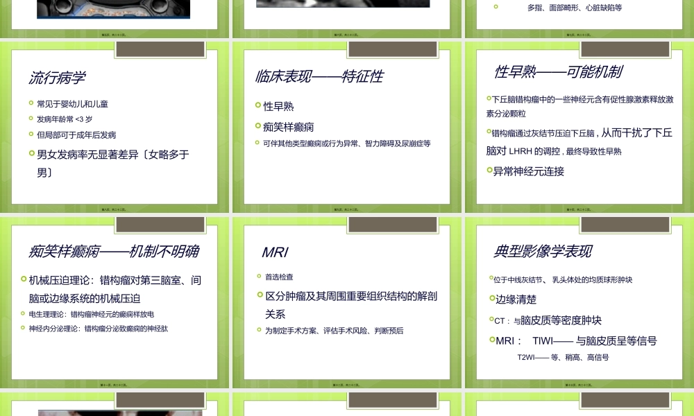 下丘脑错构瘤.ppt