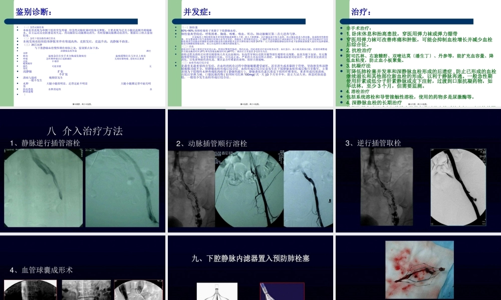 下肢深静脉血栓.pptx