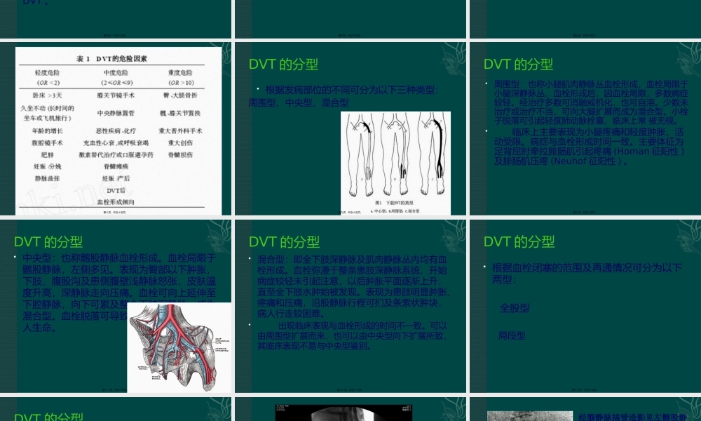 下肢深静脉血栓形成的诊治--刘凯.pptx