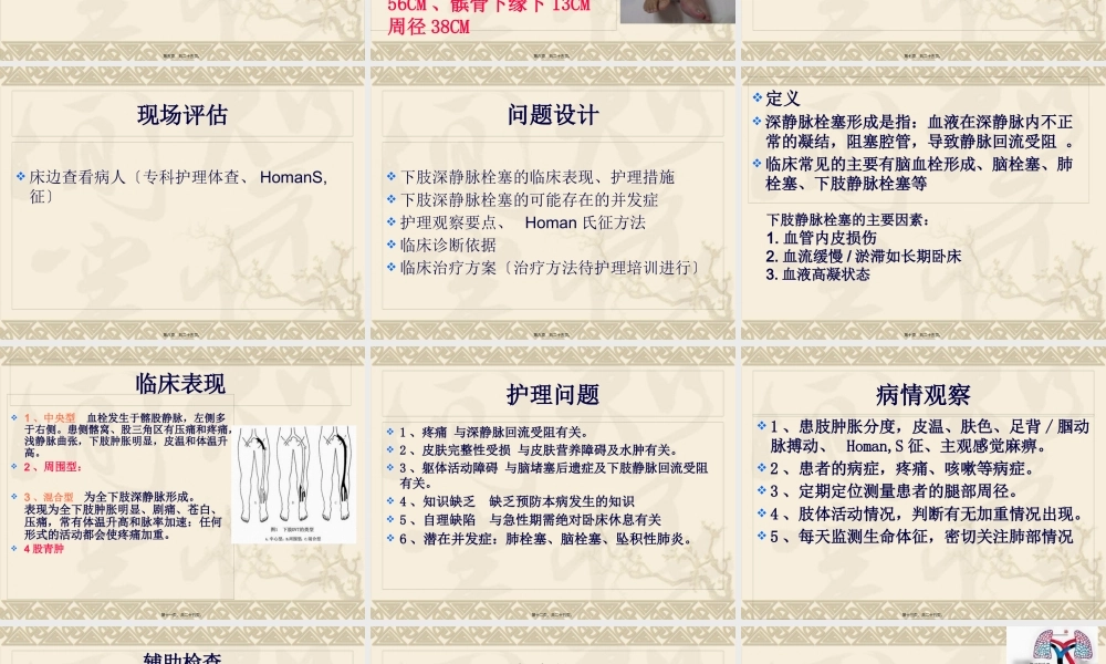 下肢深静脉血栓查房.pptx