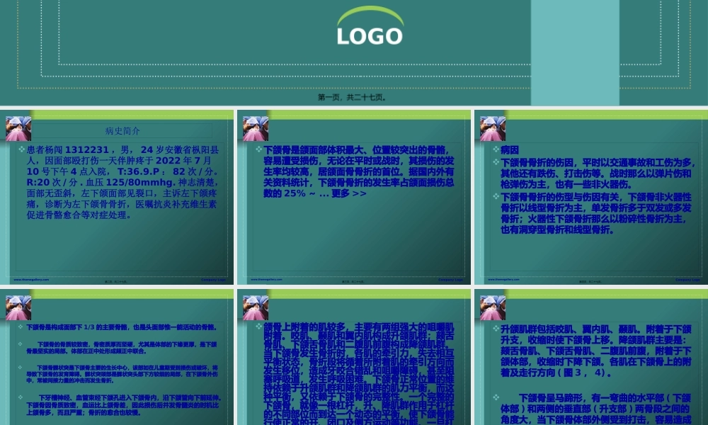 下颌骨骨折教学查房材料.pptx