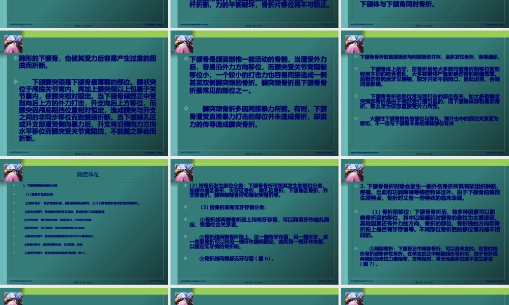 下颌骨骨折教学查房.pptx