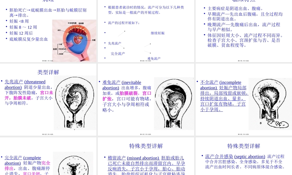 不全流产.pptx