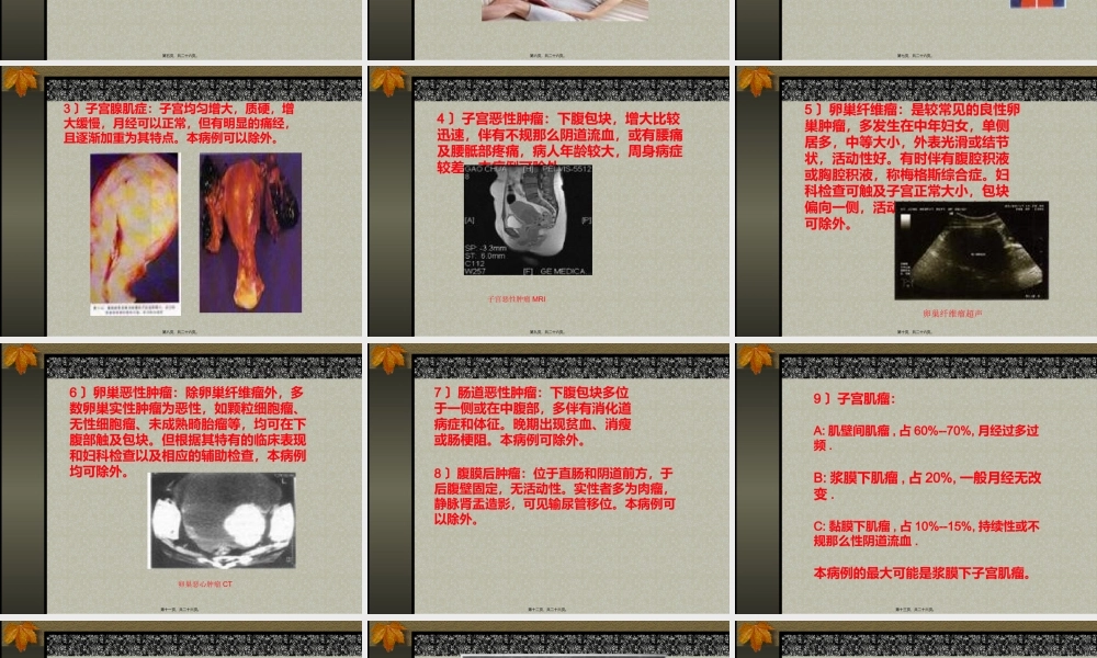 下腹部包块.pptx