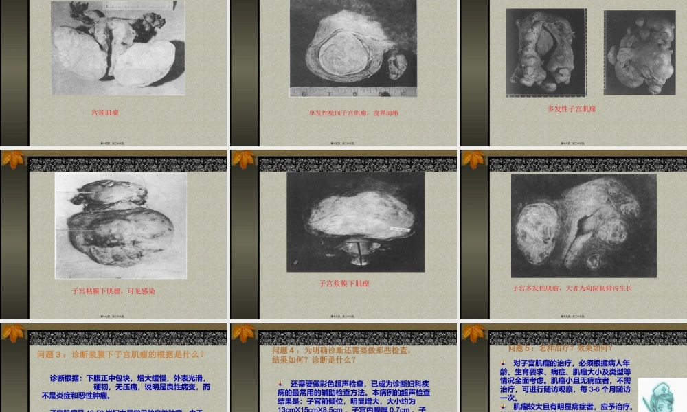下腹部包块.pptx