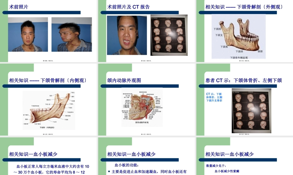 下颌骨骨折查房.pptx