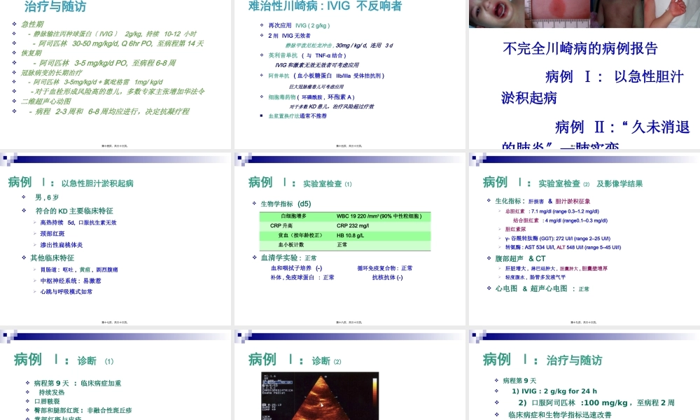 不典型川崎病模板.pptx