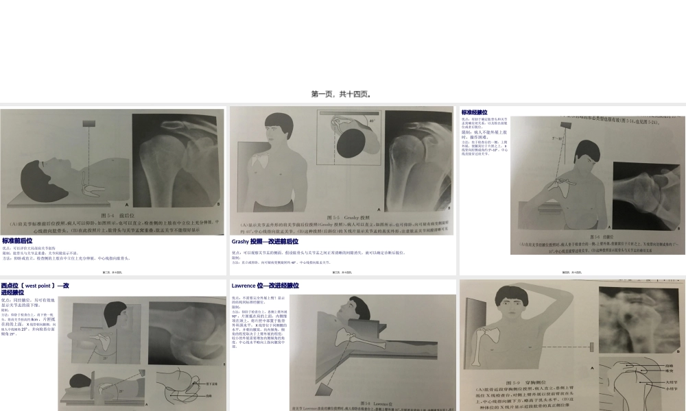 不同肩关节X线投照位.pptx