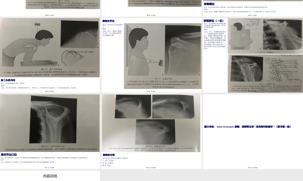 不同肩关节X线投照位.pptx