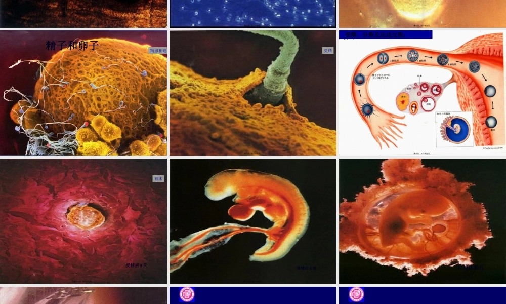 不孕与助孕2011.pptx