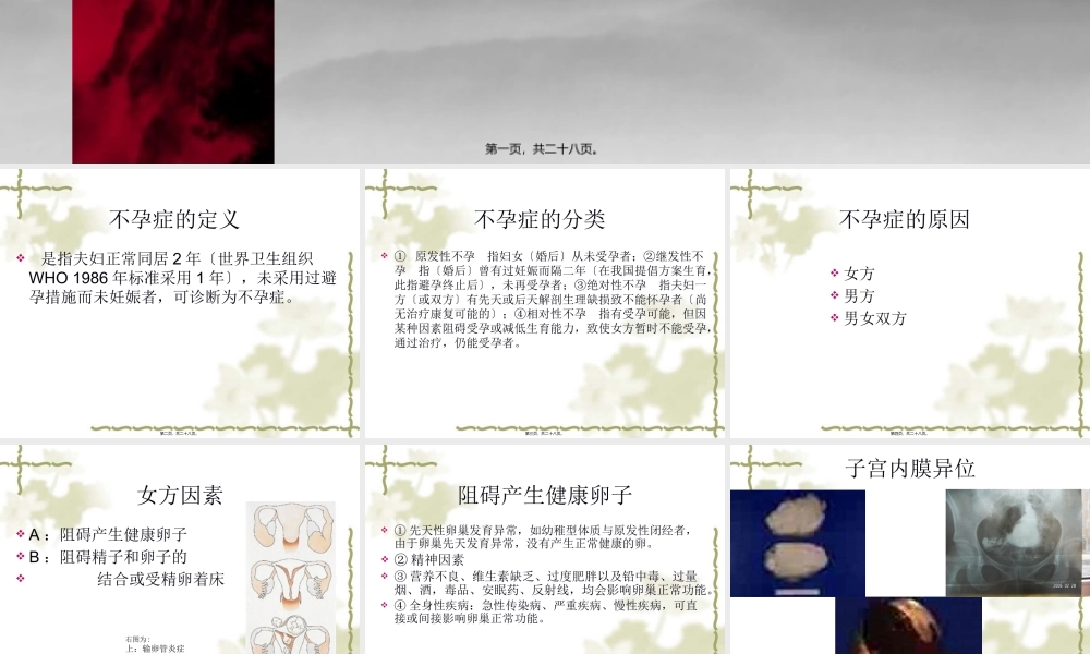 不孕症的定义概述.pptx