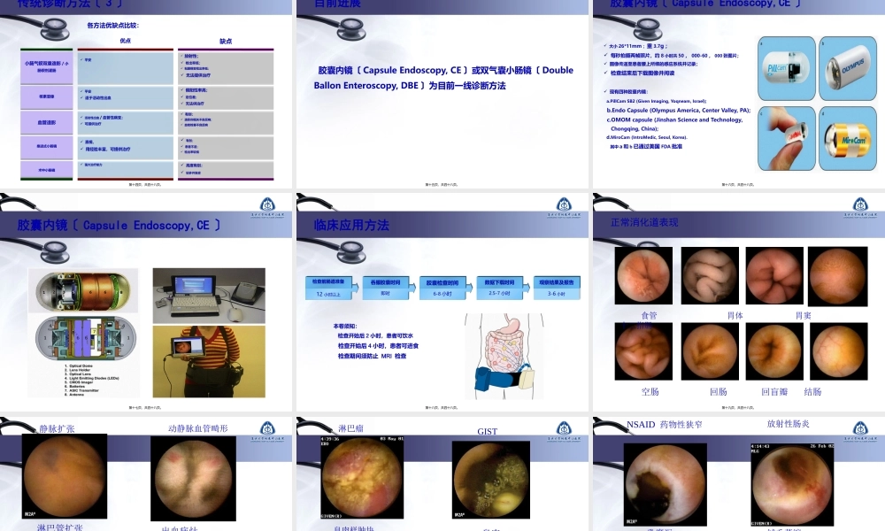 不明原因消化道出血的诊疗进展.pptx