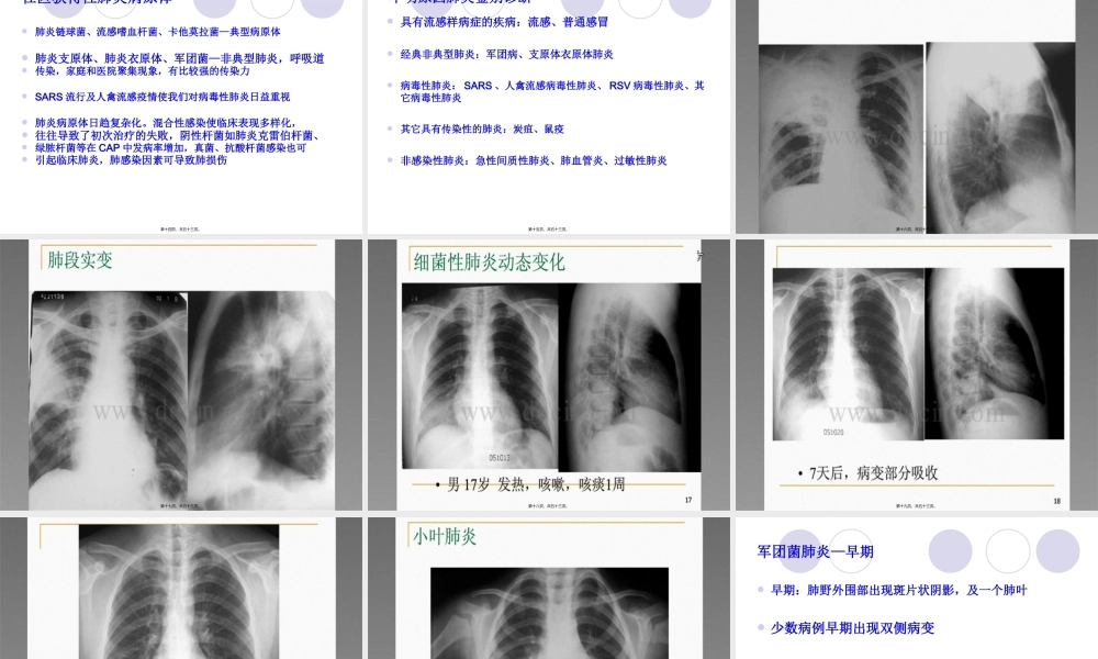 不明原因肺炎排查.pptx