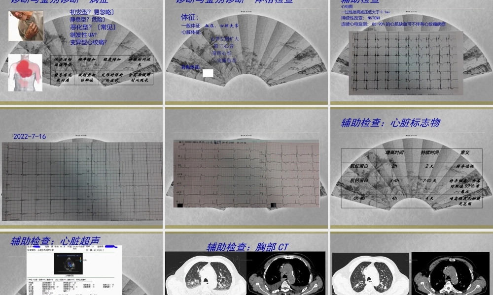 不稳定型心绞痛教学查房.ppt