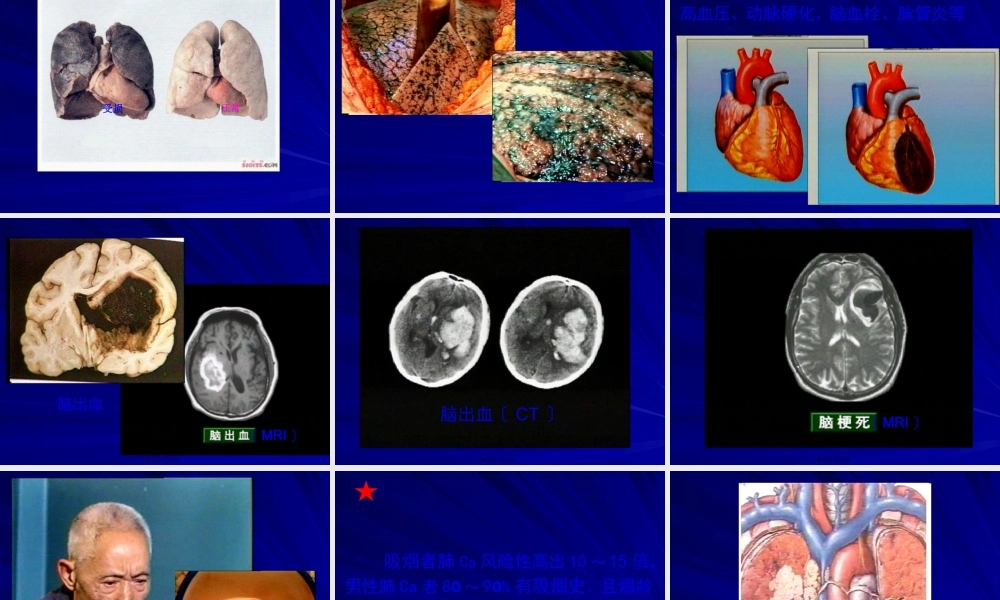 不良行为对健康的影响.pptx