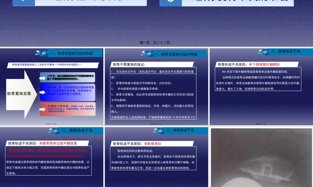 与全膝关节置换相关的髌股关节并发症.pptx