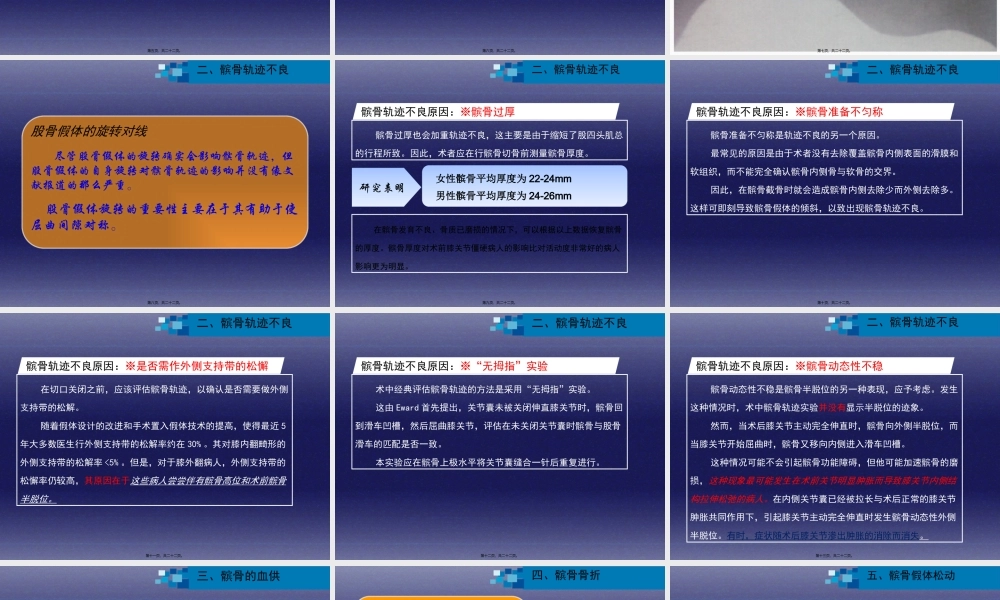 与全膝关节置换相关的髌股关节并发症.pptx