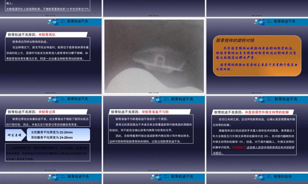 与全膝关节置换相关的髌股关节并发症...pptx