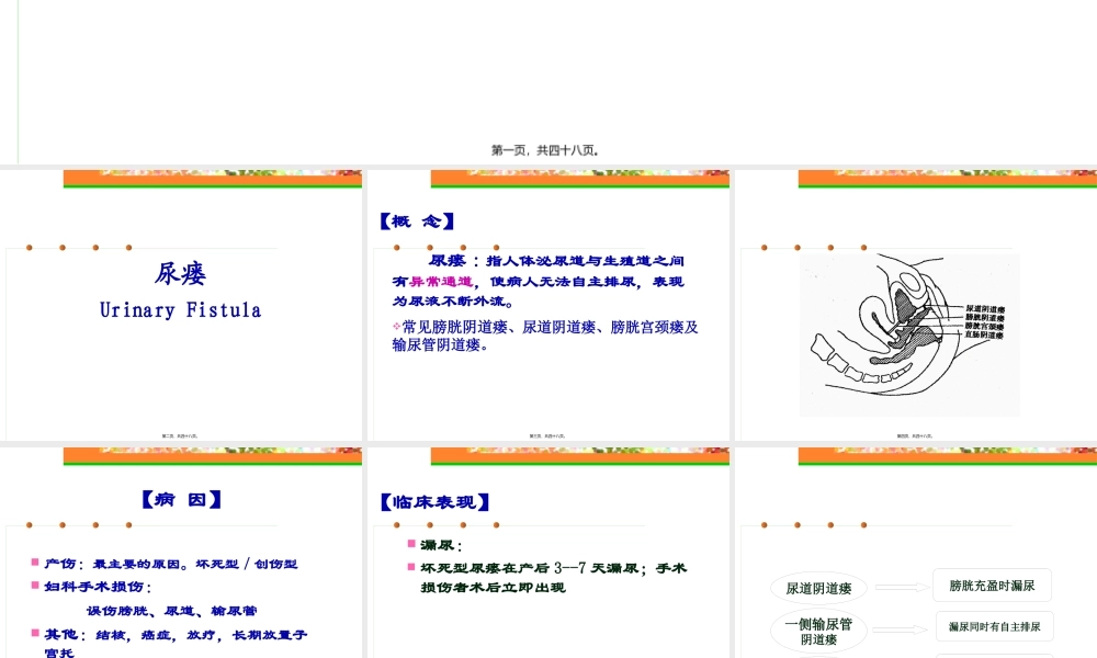 专科尿漏子宫脱垂(完整版).pptx