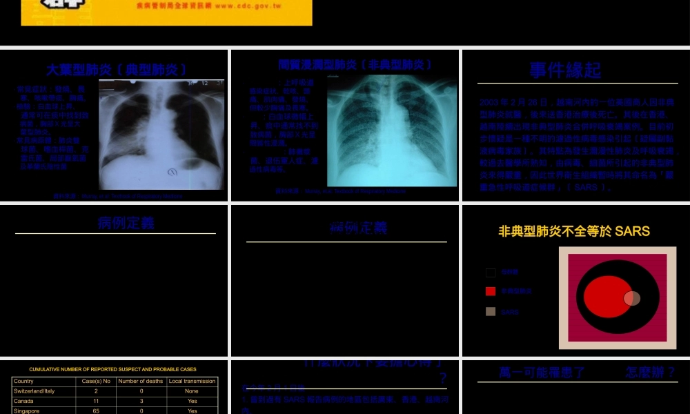 严重急性呼吸道症候群.pptx