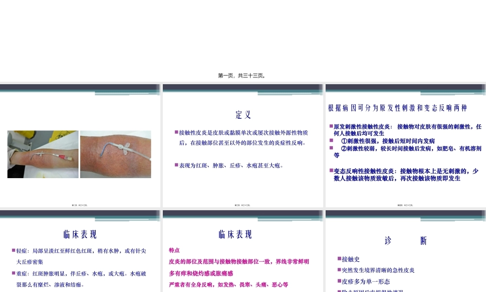 严重的接触性皮炎的处理..精讲.pptx