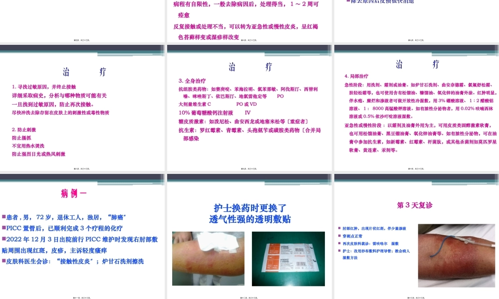 严重的接触性皮炎的处理..精讲.pptx
