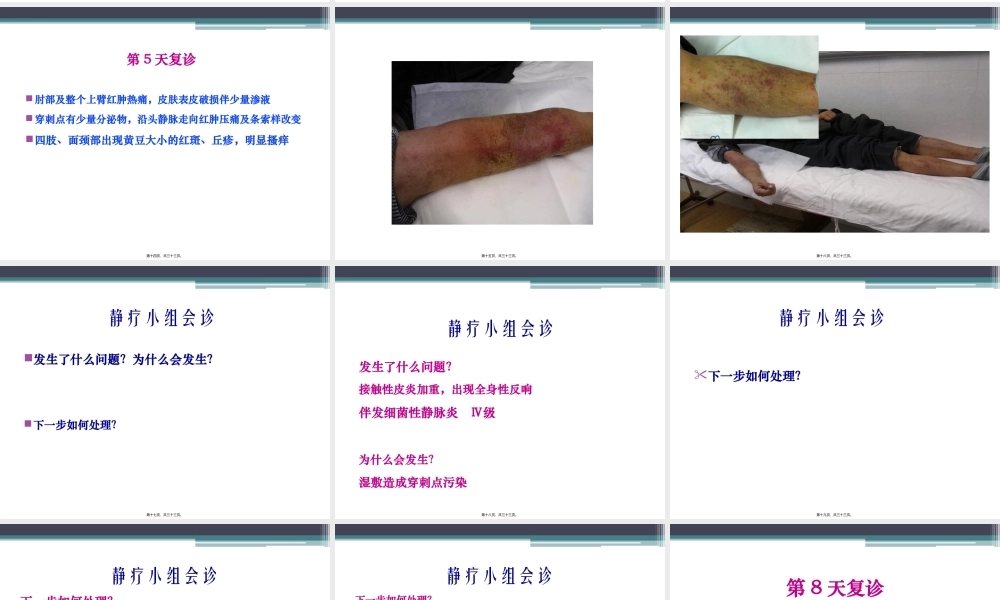 严重的接触性皮炎的处理..精讲.pptx