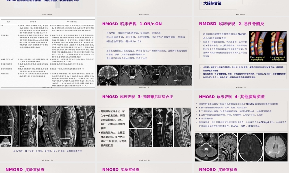 中国NMOSD诊治指南2015.pptx