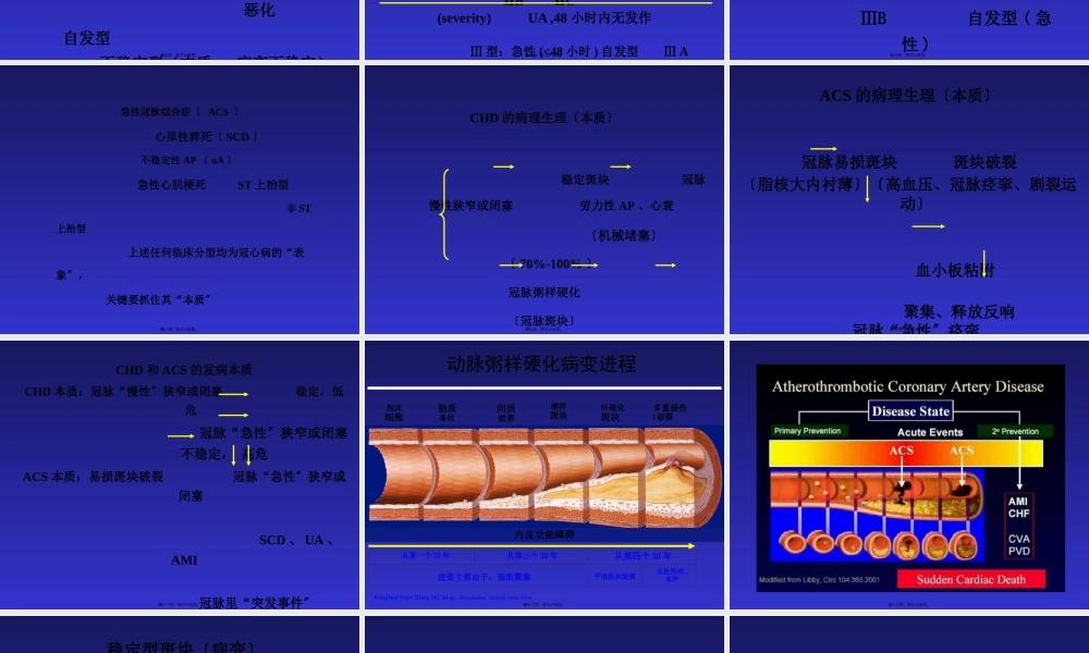 中国医科院、阜外医院：急性冠脉综合症.pptx