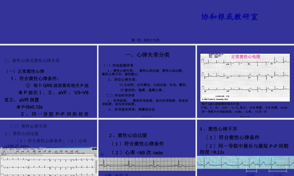 中国协和医院心电图详解.pptx