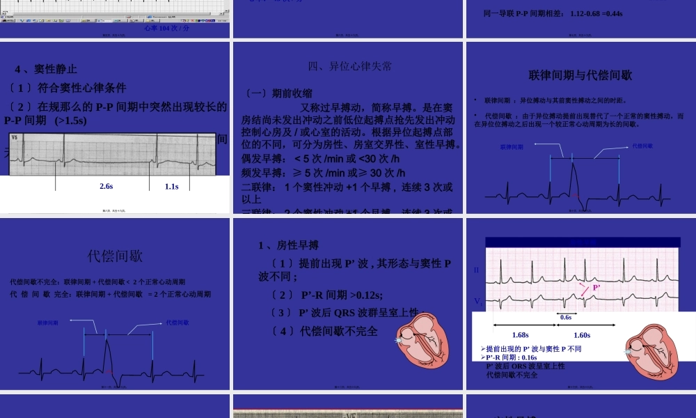中国协和医院心电图详解.pptx