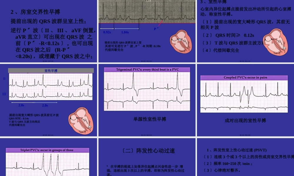 中国协和医院心电图详解.pptx
