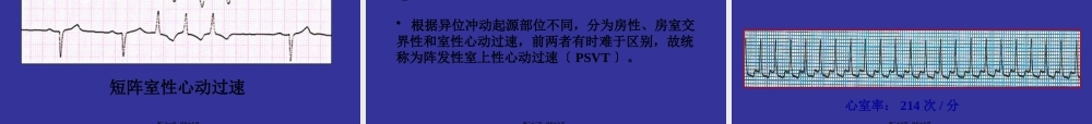 中国协和医院心电图详解.pptx